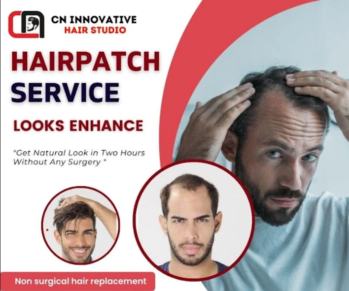 Top 10 Hair Patchs in Pune Cost A to Z Information